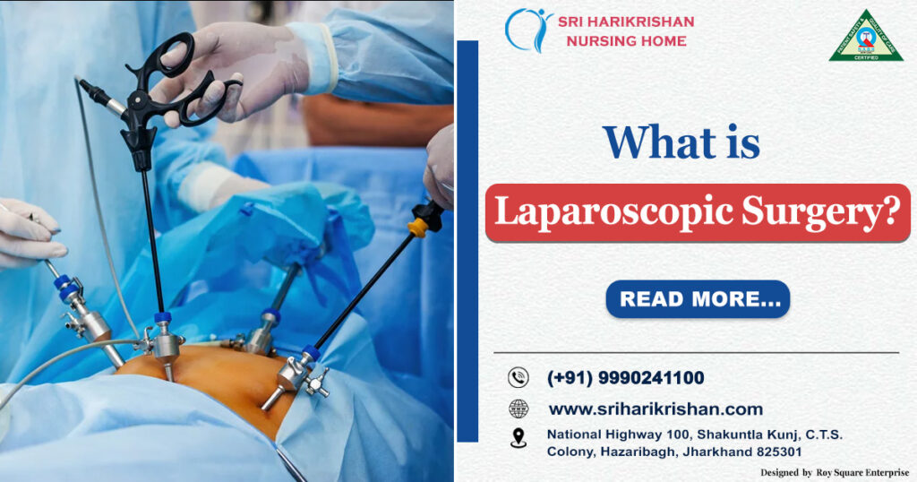 Laparoscopic Surgery