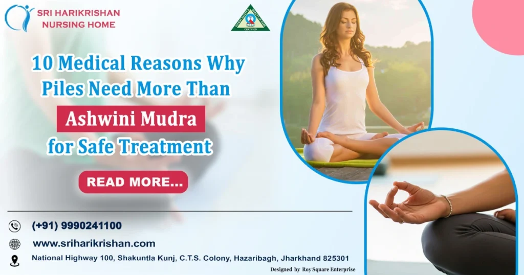 10 Medical Reasons Why Piles Need More Than Ashwini Mudra for Safe Treatment