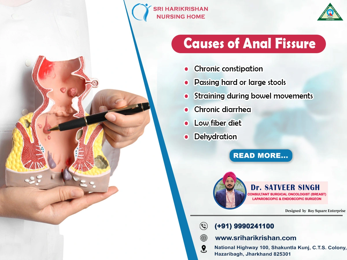 Causes of Anal Fissure