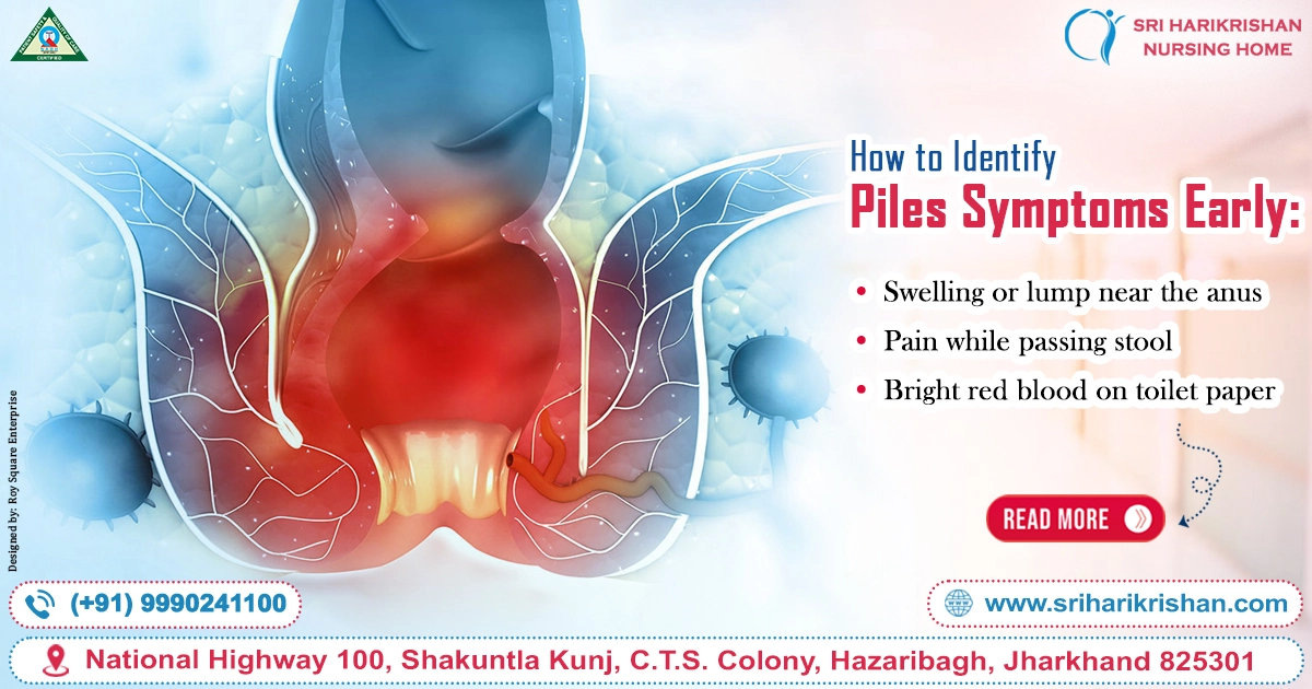 How to Identify Piles Symptoms Early